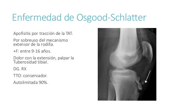 Dolor en las extremidades inferiores en ni os Dolor en las extremidades inferiores en ni os