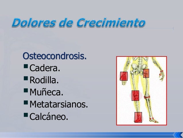 El dolor en los músculos de la espalda por el trabajo sentado