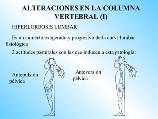 ALTERACIONES EN LA COLUMNA
              VERTEBRAL (I)
  HIPERLORDOSIS LUMBAR

    Es un aumento exagerado y progresivo de la curva lumbar
fisiológica
  2 actitudes posturales son las que inducen a esta patología:


                                Anteversión
  Antepulsión
                               pélvica
 pélvica
 