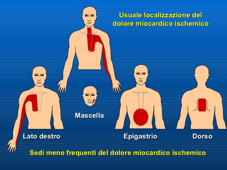 Se è possibile prende un bagno di vapore a osteochondrosis lombare