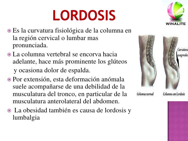 Donde curan la osteocondrosis sheynogo del departamento en ufe