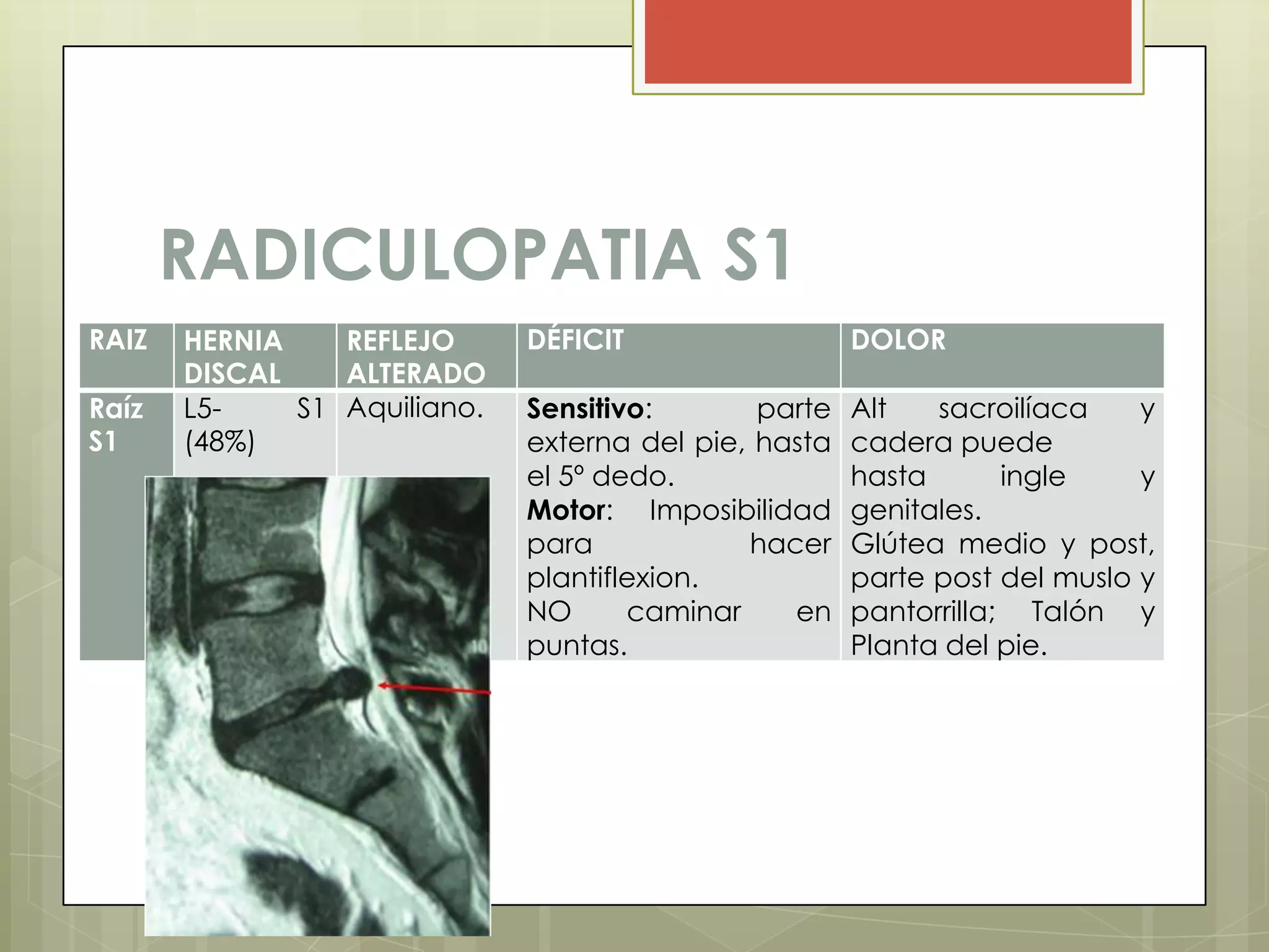 RADICULOPATIA S1
RAIZ   HERNIA    REFLEJO      DÉFICIT                  DOLOR
       DISCAL    ALTERADO
Raíz   L5-    S1 Aquiliano.   Sensitivo:       parte   Alt   sacroilíaca    y
S1     (48%)                  externa del pie, hasta   cadera puede
                              el 5º dedo.              hasta       ingle    y
                              Motor: Imposibilidad     genitales.
                              para            hacer    Glútea medio y post,
                              plantiflexion.           parte post del muslo y
                              NO      caminar    en    pantorrilla; Talón y
                              puntas.                  Planta del pie.
 