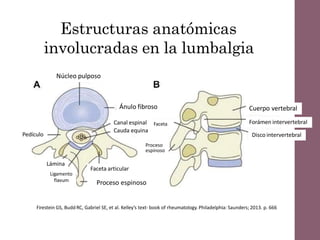 Estructuras anatómicas
involucradas en la lumbalgia
Núcleo pulposo
Ánulo fibroso
Proceso espinoso
Pedículo
Lámina
Ligamento
flavum
Canal espinal
Cauda equina
Faceta articular
Proceso espinoso
Proceso
espinoso
Cuerpo vertebral
Forámen intervertebral
Disco intervertebral
Faceta
Firestein GS, Budd RC, Gabriel SE, et al. Kelley’s text- book of rheumatology. Philadelphia: Saunders; 2013. p. 666
 