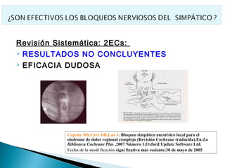 Revisión Sistemática: 2ECs:
   RESULTADOS NO CONCLUYENTES
   EFICACIA DUDOSA




            Cepeda MS,Carr DB,Lau J. Bloqueo simpático anestésico local para el
            síndrome de dolor regional complejo (Revisión Cochrane traducida).En:La
            Biblioteca Cochrane Plus ,2007 Número 1.Oxford:Update Software Ltd.
            Fecha de la modi ficación signi ficativa más reciente:30 de mayo de 2005
 