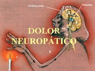 DOLOR
NEUROPÁTICO
 