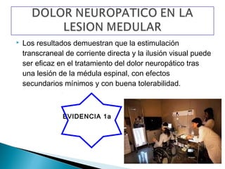    Los resultados demuestran que la estimulación
    transcraneal de corriente directa y la ilusión visual puede
    ser eficaz en el tratamiento del dolor neuropático tras
    una lesión de la médula espinal, con efectos
    secundarios mínimos y con buena tolerabilidad.



                EVIDENCIA 1a
 