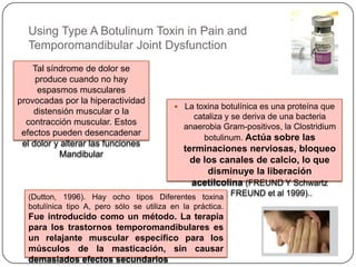 Using Type A Botulinum Toxin in Pain and
Temporomandibular Joint Dysfunction
 La toxina botulínica es una proteína que
cataliza y se deriva de una bacteria
anaerobia Gram-positivos, la Clostridium
botulinum. Actúa sobre las
terminaciones nerviosas, bloqueo
de los canales de calcio, lo que
disminuye la liberación
acetilcolina (FREUND Y Schwartz
1998; FREUND et al 1999)..
Tal síndrome de dolor se
produce cuando no hay
espasmos musculares
provocadas por la hiperactividad
distensión muscular o la
contracción muscular. Estos
efectos pueden desencadenar
el dolor y alterar las funciones
Mandibular
(Dutton, 1996). Hay ocho tipos Diferentes toxina
botulínica tipo A, pero sólo se utiliza en la práctica.
Fue introducido como un método. La terapia
para los trastornos temporomandibulares es
un relajante muscular específico para los
músculos de la masticación, sin causar
demasiados efectos secundarios
 