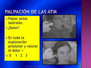  Palpar polos
laterales.
 ¿Dolor?
 En toda la
exploración
presionar y valorar
el dolor =
 0 1 2 3
01/08/2013 20DR.gian carlo muñoz ramos
 