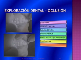 01/08/2013 22DR.gian carlo muñoz ramos
 