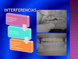 01/08/2013 23DR.gian carlo muñoz ramos
 