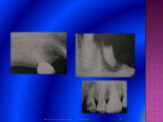 01/08/2013 35DR.gian carlo muñoz ramos
 