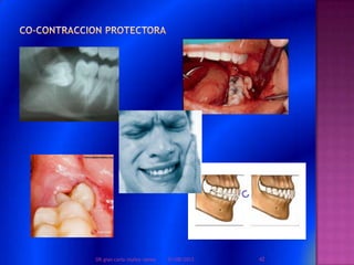 01/08/2013 42DR.gian carlo muñoz ramos
 