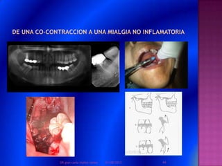 01/08/2013 44DR.gian carlo muñoz ramos
 