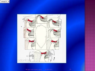 01/08/2013 53DR.gian carlo muñoz ramos
Buscarform-Kn-lysearch_bl
 