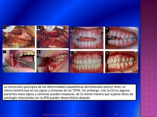 La corrección quirúrgica de las deformidades esqueléticas dentofaciales parece tener un
efecto beneficioso en los signos y síntomas de los TDTM. Sin embargo, tras la CO en algunos
pacientes estos signos y síntomas pueden empeorar, de la misma manera que sujetos libres de
patología relacionada con la ATM pueden desarrollarla después
01/08/2013 59DR.gian carlo muñoz ramos
 