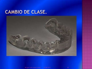 01/08/2013 63DR.gian carlo muñoz ramos
 