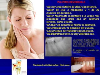 PULPITIS REVERSIBLE No hay antecedente de dolor espontaneo. Dolor de leve a moderado y < de 20 minutos de duración. Dolor fácilmente localizable o a veces mal localizado que inicia con un estimulo térmico, dulce o tacto. El dolor se suprime al retirar el estimulo. No afectado por la posición del cuerpo. Las pruebas de vitalidad son positivas. Radiográficamente no hay alteraciones. Pruebas de vitalidad pulpar: Hielo seco El cemento y el esmalte, son insensibles La sensación de dolor dentario se origina en los receptores situados en la pulpa (que está dotada de fibras nerviosas) o la dentina. 
