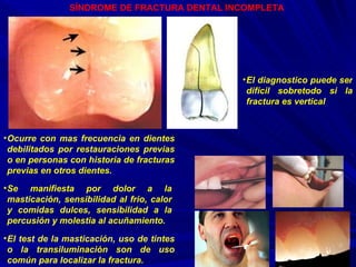 SÍNDROME DE FRACTURA DENTAL INCOMPLETA   Ocurre con mas frecuencia en dientes debilitados por restauraciones previas o en personas con historia de fracturas previas en otros dientes. El diagnostico puede ser difícil sobretodo si la fractura es vertical El test de la masticación, uso de tintes o la transiluminación son de uso común para localizar la fractura. Se manifiesta por dolor a la masticación, sensibilidad al frio, calor y comidas dulces, sensibilidad a la percusión y molestia al acuñamiento. 