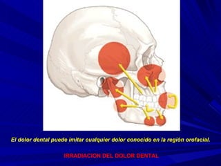 IRRADIACION DEL DOLOR DENTAL El dolor dental puede imitar cualquier dolor conocido en la región orofacial. 