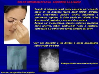 Cuando el origen es nasal puede causarse por: contacto septal en las mucosas (pared nasal lateral), alergias, rinitis vasomotoras, pólipos, trauma, neoplasias o hematomas septales. El dolor puede ser referido a las áreas frontal, posterior y temporal de la cabeza. Aunque son inespecíficos, algunos síntomas asociados como rinorrea, fiebre, obstrucción nasal o epistaxis, corroboran a la nariz como fuente primaria del dolor. DOLOR OROMAXILOFACIAL  ASOCIADO A LA NARIZ   Hay que descartar a los dientes o senos paranasales como origen del dolor. Absceso periapical incisivo superior Radiopacidad en seno maxilar izquierdo 