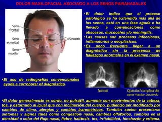 DOLOR MAXILOFACIAL ASOCIADO A LOS SENOS PARANASALES El dolor indica que el proceso patológico se ha extendido más allá de los senos, está en una fase aguda o ha llevado a complicaciones como abscesos, mucoceles y/o meningitis.  Las causas son procesos infecciosos, inflamatorios o neoplásicos. Es poco frecuente llegar a un diagnóstico sin la presencia de hallazgos anormales en el examen nasal. El dolor generalmente es sordo, no pulsátil, aumenta con movimientos de la cabeza, tos, y estornudo al igual que con inclinación del cuerpo, pudiendo ser modificado por cambios de clima, alergias y cambios barométricos . También suelen presentarse síntomas y signos tales como congestión nasal, cambios olfatorios, cambios en la densidad o color del flujo nasal, fiebre, halitosis, tos, irritabilidad, hinchazón y eritema.  El uso de radiografías convencionales ayuda a corroborar el diagnóstico . Normal Opacidad completa del seno maxilar izquierdo 