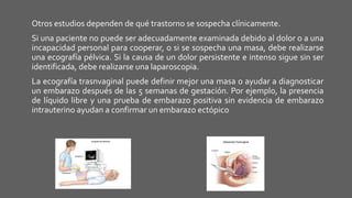 Otros estudios dependen de qué trastorno se sospecha clínicamente.
Si una paciente no puede ser adecuadamente examinada debido al dolor o a una
incapacidad personal para cooperar, o si se sospecha una masa, debe realizarse
una ecografía pélvica. Si la causa de un dolor persistente e intenso sigue sin ser
identificada, debe realizarse una laparoscopia.
La ecografía trasnvaginal puede definir mejor una masa o ayudar a diagnosticar
un embarazo después de las 5 semanas de gestación. Por ejemplo, la presencia
de líquido libre y una prueba de embarazo positiva sin evidencia de embarazo
intrauterino ayudan a confirmar un embarazo ectópico
 