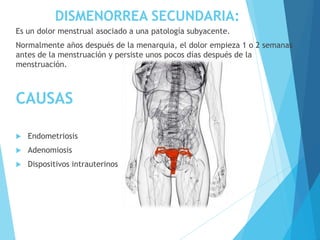 DISMENORREA SECUNDARIA:
Es un dolor menstrual asociado a una patología subyacente.
Normalmente años después de la menarquia, el dolor empieza 1 o 2 semanas
antes de la menstruación y persiste unos pocos días después de la
menstruación.
CAUSAS
 Endometriosis
 Adenomiosis
 Dispositivos intrauterinos
 
