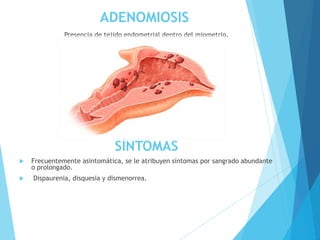 ADENOMIOSIS
Presencia de tejido endometrial dentro del miometrio.
SÍNTOMAS
 Frecuentemente asintomática, se le atribuyen síntomas por sangrado abundante
o prolongado.
 Dispaurenia, disquesia y dismenorrea.
 