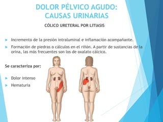 DOLOR PÉLVICO AGUDO:
CAUSAS URINARIAS
CÓLICO URETERAL POR LITIASIS
 Incremento de la presión intraluminal e inflamación acompañante.
 Formación de piedras o cálculos en el riñón. A partir de sustancias de la
orina, las más frecuentes son los de oxalato cálcico.
Se caracteriza por:
 Dolor intenso
 Hematuria
 