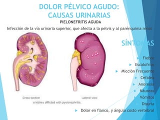 DOLOR PÉLVICO AGUDO:
CAUSAS URINARIAS
PIELONEFRITIS AGUDA
Infección de la vía urinaria superior, que afecta a la pelvis y al parénquima renal
SÍNTOMAS
 Fiebre
 Escalofríos
 Micción Frecuente
 Cefalea
 Anorexia
 Náuseas
 Vómitos
 Disuria
 Dolor en flanco, y ángulo costo vertebral
 