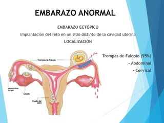 EMBARAZO ANORMAL
EMBARAZO ECTÓPICO
Implantación del feto en un sitio distinto de la cavidad uterina
LOCALIZACIÓN
- Trompas de Falopio (95%)
- Abdominal
- Cervical
 
