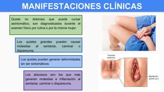 MANIFESTACIONES CLÍNICAS
Quiste no doloroso que puede cursar
asintomático, son diagnosticados durante el
examen físico por rutina o por la misma mujer.
Los quistes grandes pueden causar
molestias al sentarse, caminar o
dispareunia.
Los quistes pueden generar deformidades
sin ser sintomáticos
Los abscesos son los que más
generan molestias e inflamación al
sentarse, caminar o dispareunia.
 
