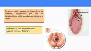 Es una anomalía congénita del desarrollo genital
femenino, caracterizada por falta de
canalización de tejido conectivo que conforma el
himen.
Conlleva a la falta de permeabilidad
vaginal, acúmulos de sangre
 