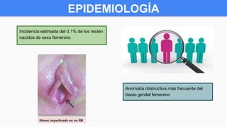 Incidencia estimada del 0.1% de los recién
nacidos de sexo femenino
Anomalía obstructiva más frecuente del
tracto genital femenino
EPIDEMIOLOGÍA
 