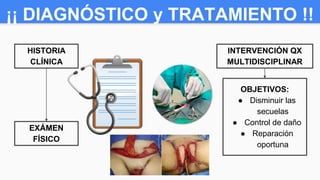 ¡¡ DIAGNÓSTICO y TRATAMIENTO !!
HISTORIA
CLÍNICA
INTERVENCIÓN QX
MULTIDISCIPLINAR
EXÁMEN
FÍSICO
OBJETIVOS:
● Disminuir las
secuelas
● Control de daño
● Reparación
oportuna
 