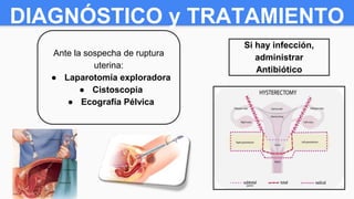 DIAGNÓSTICO y TRATAMIENTO
Ante la sospecha de ruptura
uterina:
● Laparotomía exploradora
● Cistoscopia
● Ecografía Pélvica
Si hay infección,
administrar
Antibiótico
 