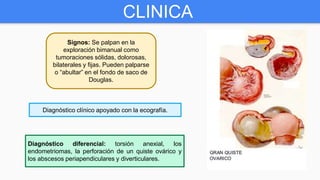 CLINICA
Signos: Se palpan en la
exploración bimanual como
tumoraciones sólidas, dolorosas,
bilaterales y fijas. Pueden palparse
o “abultar” en el fondo de saco de
Douglas.
Diagnóstico clínico apoyado con la ecografía.
Diagnóstico diferencial: torsión anexial, los
endometriomas, la perforación de un quiste ovárico y
los abscesos periapendiculares y diverticulares.
 