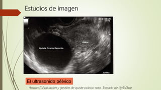 Estudios de imagen
El ultrasonido pélvico
Howard,T.Evaluacion y gestión de quiste ovárico roto. Tomado de UpToDate
 