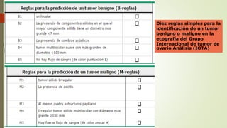 Diez reglas simples para la
identificación de un tumor
benigno o maligno en la
ecografía del Grupo
Internacional de tumor de
ovario Análisis (IOTA)
 