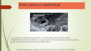 Dolor pélvico o abdominal
Si se visualiza un embarazo intrauterino, a continuación, dolor pélvico y fluido
intraperitoneal podría ser debido a un quiste ovárico roto (por ejemplo, del cuerpo lúteo
quiste, teca luteína quiste) o embarazo heterotópico.
Howard,T.Evaluacion y gestión de quiste ovárico roto. Tomado de UpToDate
 