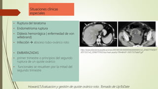 Situaciones clínicas
especiales
• Ruptura del teratoma
• Endometrioma ruptura
• Diátesis hemorrágica ( enfermedad de von
willebrand)
• Infección  absceso tubo-ovárico roto
• EMBARAZADAS
• primer trimestre o principios del segundo
ruptura de un quiste ovárico
• funcionales se resuelven por la mitad del
segundo trimestre
http://www.elsevier.es/publicaciones/00338338/0000004600000001/v0_201607111430/1
3057337/v0_201607111431/es/main.assets/119v46n01-13057337tab01.gif
Howard,T.Evaluacion y gestión de quiste ovárico roto. Tomado de UpToDate
 