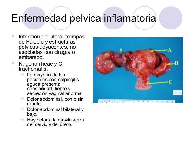 La tintura del matamoscas para el tratamiento de las articulaciones y la espalda