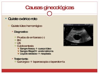Causas ginecológicas Quiste ovárico roto Quiste lúteo hemorrágico Diagnostico Prueba de embarazo (-) BH US Culdocentesis Sangre fresca    cuerpo lúteo Sangre “vieja”    endometrioma Liquido sebáceo    neoplasia Tratamiento Quirúrgico    laparoscopia o laparotomía 