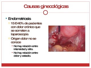 Causas ginecológicas Endometriosis 15 – 40% de pacientes con dolor crónico que se someten a laparoscopia Origen dolor no se conoce No hay relación entre intensidad y sitio. No hay relación entre dolor y estadio. 