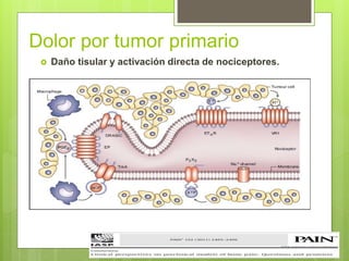 Dolor por tumor primario
 Daño tisular y activación directa de nociceptores.
 