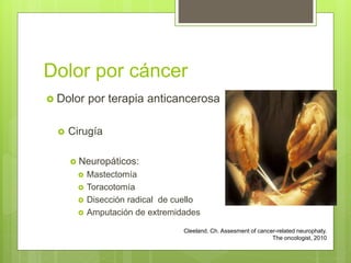 Dolor por cáncer
 Dolor por terapia anticancerosa
 Cirugía
 Neuropáticos:
 Mastectomía
 Toracotomía
 Disección radical de cuello
 Amputación de extremidades
Cleeland, Ch. Assesment of cancer-related neurophaty.
The oncologist, 2010
 
