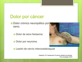 Dolor por cáncer
 Dolor crónico neuropático por cáncer de
seno:
 Dolor de seno fantasma.
 Dolor por neuroma.
 Lesión de nervio intercostabraquial
Cleeland, Ch. Assesment of cancer-related neurophaty.
The oncologist, 2010
 