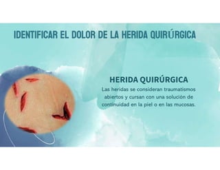 IDENTIFICAR EL DOLOR DE LA HERIDA QUIRÚRGICA
HERIDA QUIRÚRGICA
Las heridas se consideran traumatismos
abiertos y cursan con una solución de
continuidad en la piel o en las mucosas.
 