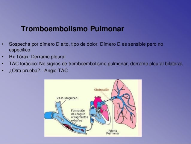 La gente también piden dolor de estomago y espalda