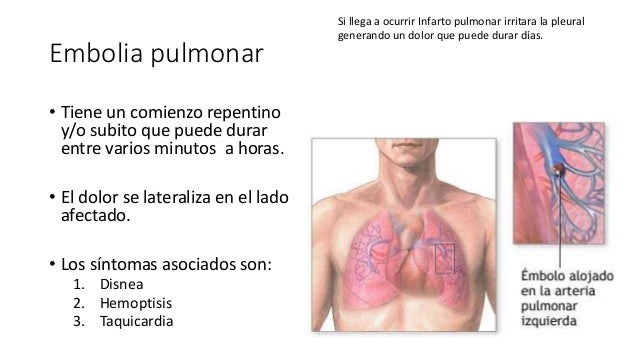 10 cosas sobre dolor de espalda dibujo